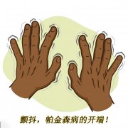 顫抖，帕金森病的開端 帕金森的癥狀有哪些